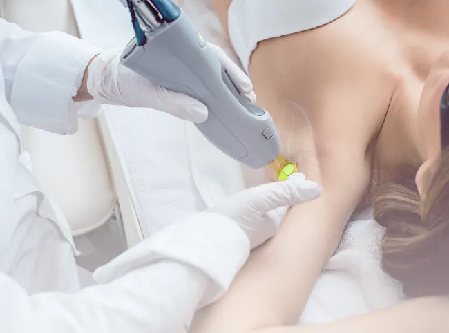 Technician performing laser hair removal on a patient's underarm