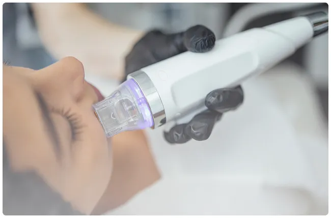 Close-up of a calm patient receiving a PRP microneedling treatment for radiant, refreshed skin
