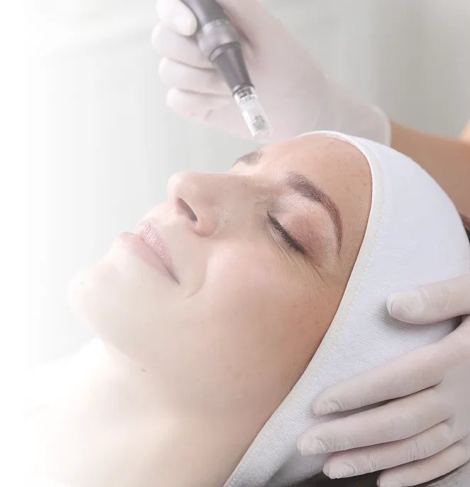 Aesthetic provider preparing a PRP microneedling treatment for a relaxed patient