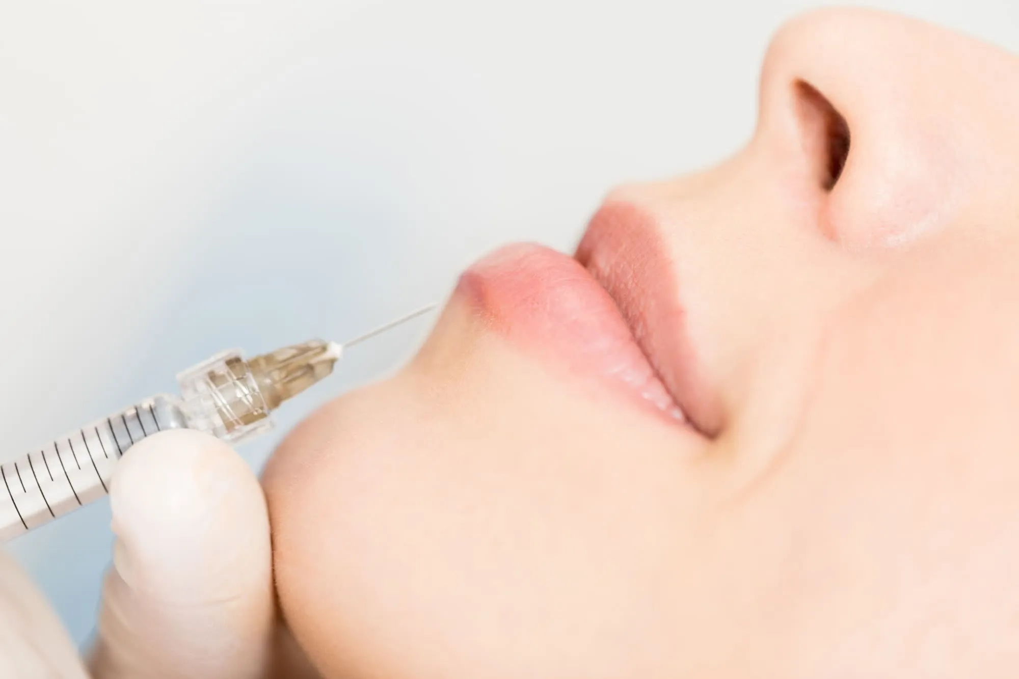Calm woman after neurotoxin treatment showing smooth, refreshed skin