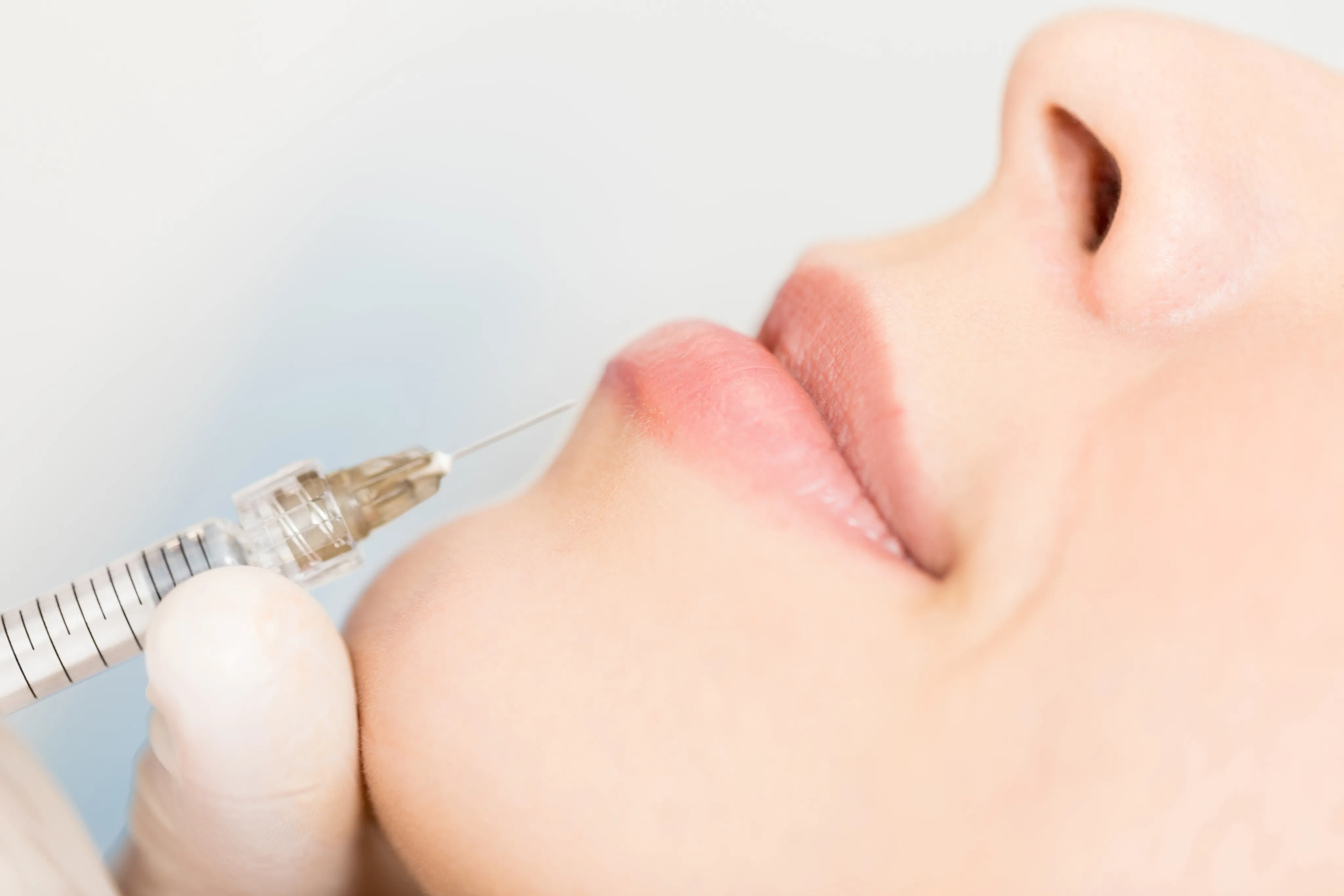 Calm woman after neurotoxin treatment showing smooth, refreshed skin